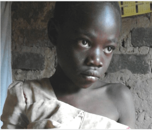 Seven-year-old bladder exstrophy